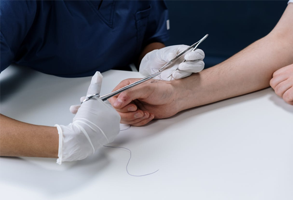 wound-management-content-img-3